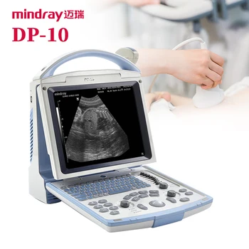 Портативен ултразвуков скенер mindray DP-10 на добра цена /скенер ултразвукова терапия mindray